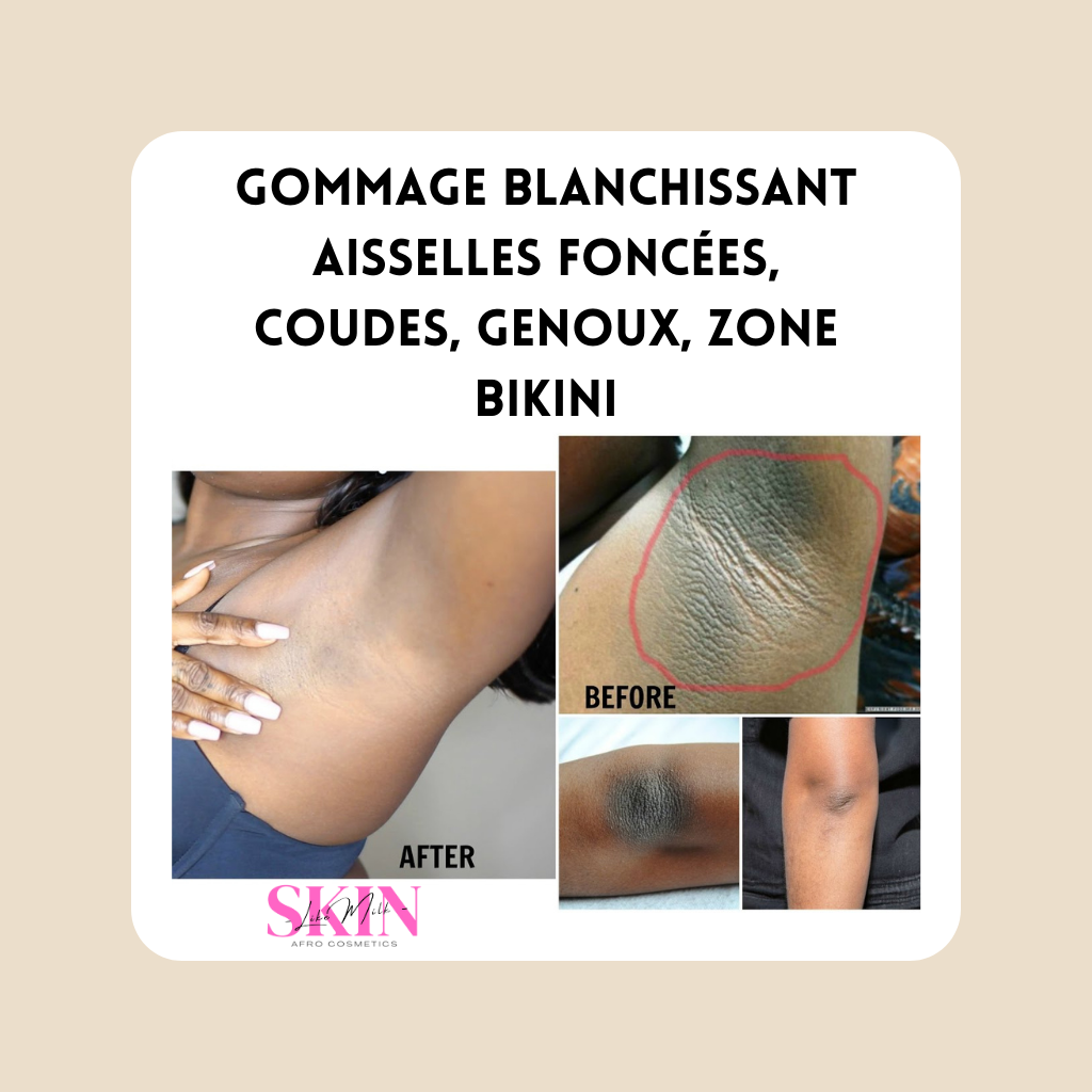 Gommage blanchissant aisselles foncées, coudes, zone bikini